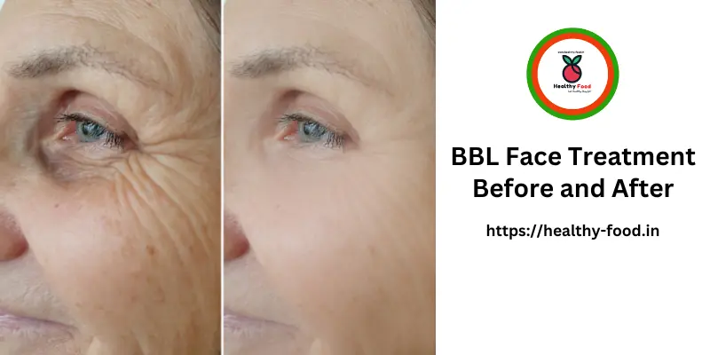 BBL Face Treatment Before and After